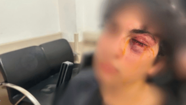 “Kurtuluş Yok Tek Başına” şarkısını söyleyen çocuğa yumruklu saldırı