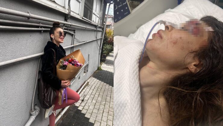İş görüşmesine giden kadına boks hocasından saldırı