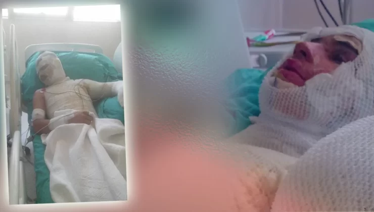 Amca, 16 yaşındaki yeğenini yakarak öldürmeye kalktı