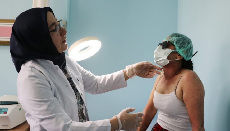 Van’da Cilt Beyazlatma Kremi Felakete Dönüştü
